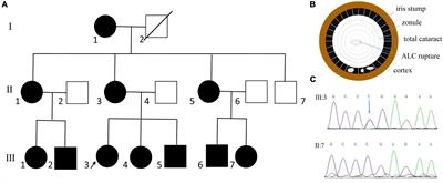 Novel clinical presentation and PAX6 mutation in families with congenital aniridia